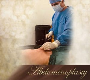 Abdominoplasty