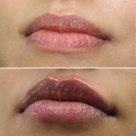 Lips12