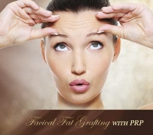 facial fat grafting with prp