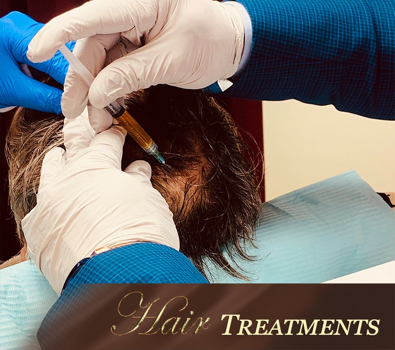 PRP therapy for hair loss