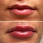 lips-july0