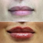lips-july6