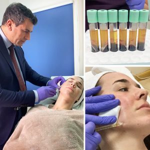 PRP Therapy