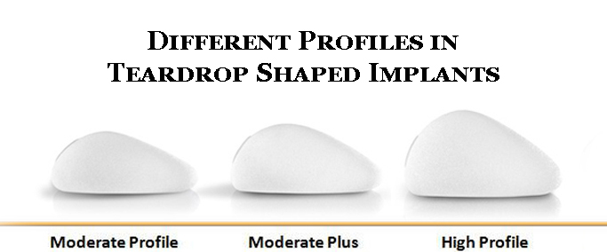 5 Things You Should Know About Size, Shape & Profile of Breast Implants