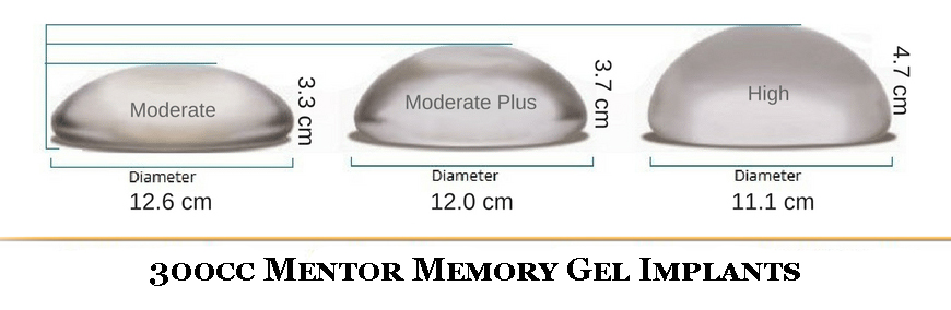 Mentor Memory Gel Implant Size Guide