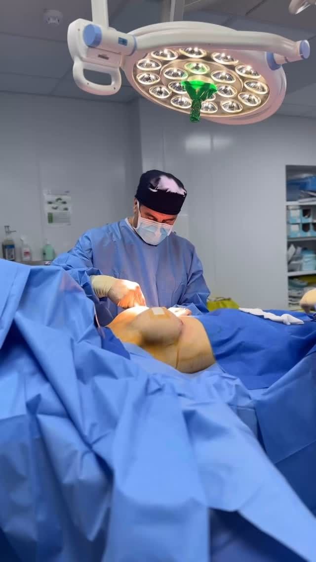 //TRUST THE PROCESS // Before, 1 Week & 5 Weeks out from SubMuscular Breast Augmentation… #NaturalLook #NaturalResults #DrAllenRezai
Detailed Consultation, Correct Implant Selection & Surgical Planning are key in achieving the most natural result and best possible outcome for You... 
.
⚜️For Enquiries DM or Call Your Preferred Clinic:
.
👉🏻🇦🇪 Dubai @EliteClinicDubai 
📞+971 (0)4431 2396 
.
👉🏻🇬🇧 London Harley Street & East Sussex @DrAllenRezai 
👉🏻 SkinCare @SkinCision_Clinic 
📞+44 (0)20 7580 8001