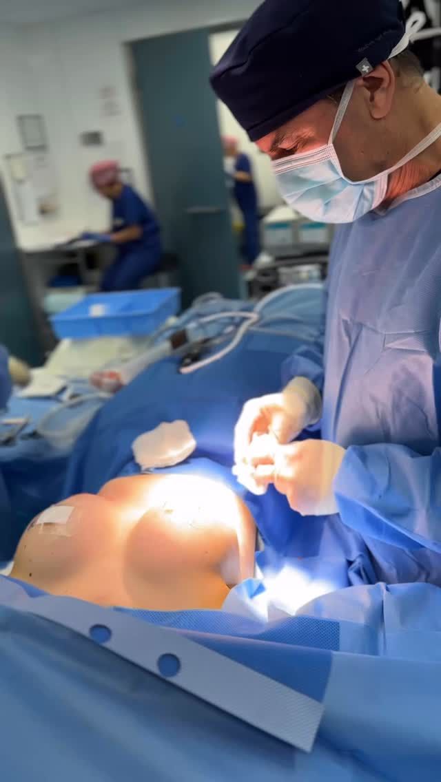 // TUBEROUS BREAST CORRECTION // Bespoke “Natural Look” Tuberous Breast Correction Surgery. Trust The Process… #DrAllenRezai 
Detailed Consultation & a Bespoke Surgical Plan are key in achieving natural results and the best possible outcome for You... #naturallook #naturalresults #tuberousbreastcorrection 
⚜️For Enquiries DM or Call Your Preferred Clinic:
.
👉🏻🇦🇪 Dubai @EliteClinicDubai 
📞+971 (0)4431 2396 
.
👉🏻🇬🇧 London & East Sussex @DrAllenRezai 
👉🏻 SkinCare @SkinCision_Clinic 
📞+44 (0)20 7580 8001
#plasticsurgery #plasticsurgerybeforeandafter #beforeandafter #confidenceissexy #cosmeticsurgery